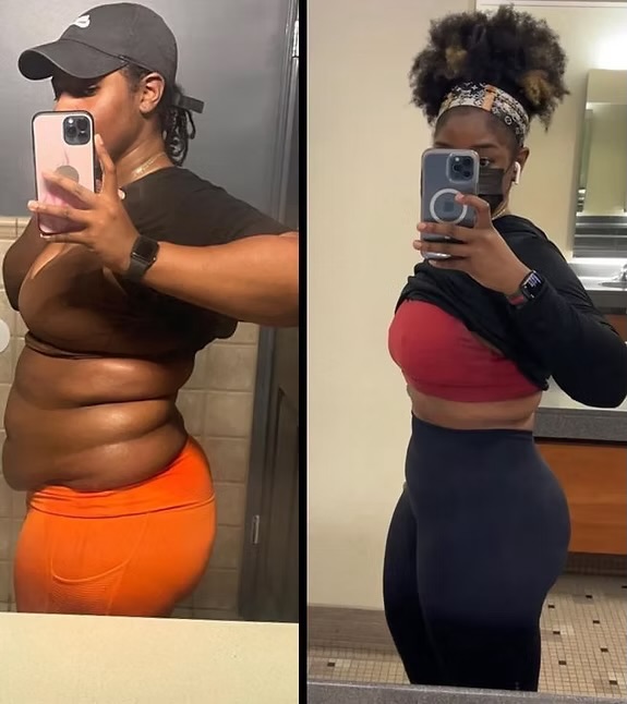 Antes e depois mostrando barriga desinchando